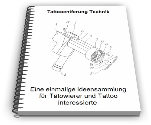 Tattooentfernung Technik