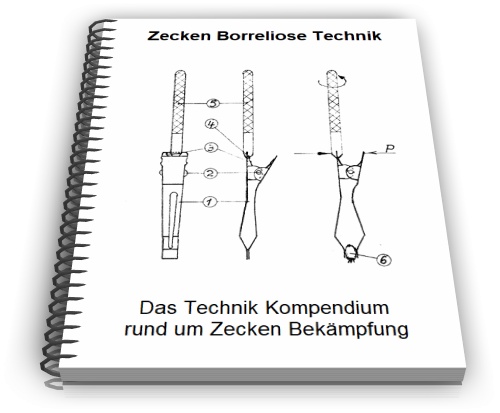 Zecken Borreliose Technik